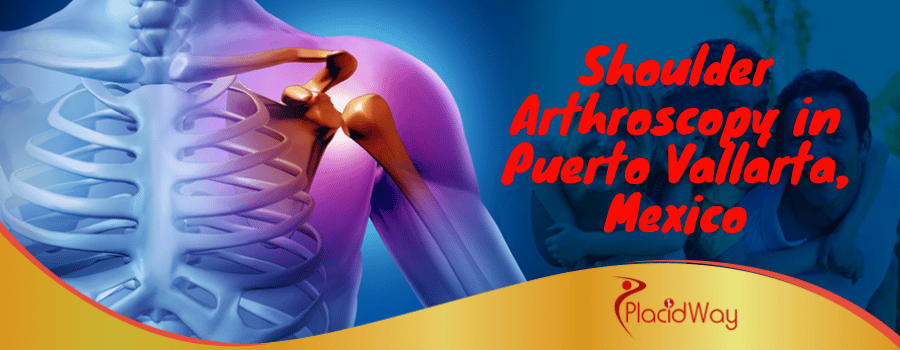 Shoulder Arthroscopy in Puerto Vallarta, Mexico